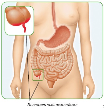 Иллюстрация к книге — Энциклопедия диагностики и лечения от А до Я [i_020.jpg]