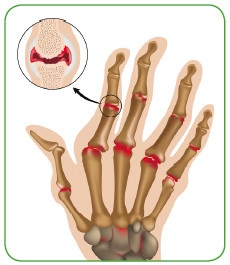Иллюстрация к книге — Энциклопедия диагностики и лечения от А до Я [i_026.jpg]