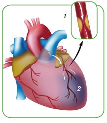 Иллюстрация к книге — Энциклопедия диагностики и лечения от А до Я [i_117.jpg]