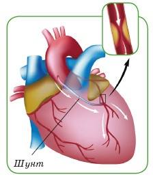 Иллюстрация к книге — Энциклопедия диагностики и лечения от А до Я [i_119.jpg]