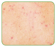 Иллюстрация к книге — Энциклопедия диагностики и лечения от А до Я [i_137.jpg]