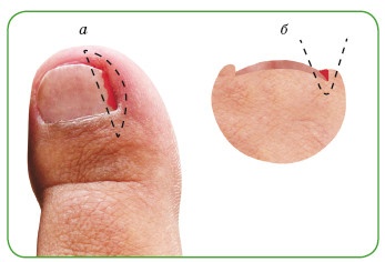 Иллюстрация к книге — Энциклопедия диагностики и лечения от А до Я [i_142.jpg]