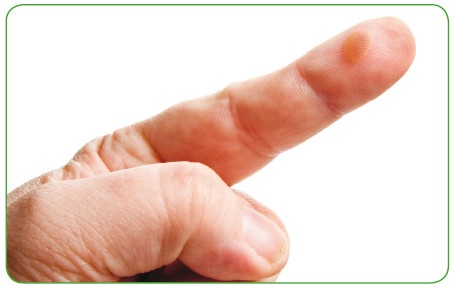 Иллюстрация к книге — Энциклопедия диагностики и лечения от А до Я [i_155.jpg]