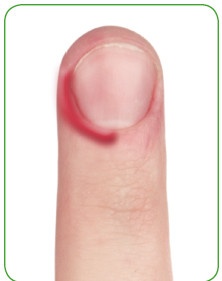 Иллюстрация к книге — Энциклопедия диагностики и лечения от А до Я [i_156.jpg]