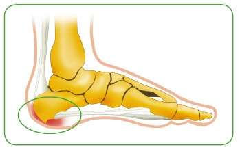 Иллюстрация к книге — Энциклопедия диагностики и лечения от А до Я [i_173.jpg]