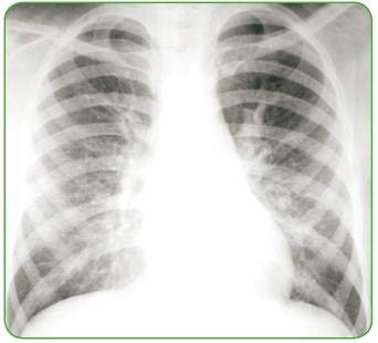 Иллюстрация к книге — Энциклопедия диагностики и лечения от А до Я [i_204.jpg]