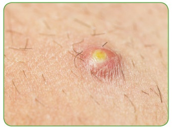 Иллюстрация к книге — Энциклопедия диагностики и лечения от А до Я [i_207.jpg]