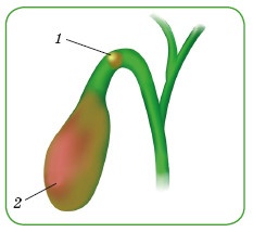 Иллюстрация к книге — Энциклопедия диагностики и лечения от А до Я [i_209.jpg]