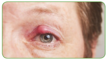 Иллюстрация к книге — Энциклопедия диагностики и лечения от А до Я [i_218.jpg]