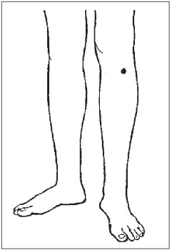 Иллюстрация к книге — Болезни от А до Я. Традиционное и нетрадиционное лечение [i_018.jpg]