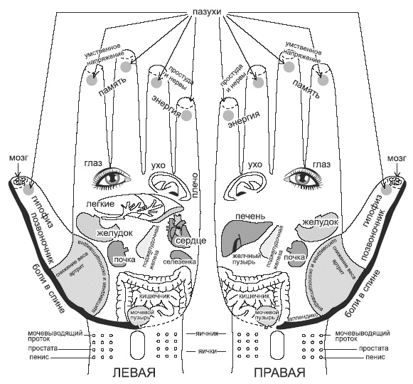 Иллюстрация к книге — Жизнь после инсульта [autogen_ebook_id1.jpg]