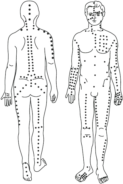 Иллюстрация к книге — Гипертония. Самые эффективные методы лечения [autogen_ebook_id2.jpg]