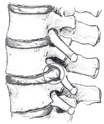 Иллюстрация к книге — Как избавиться от боли в спине [i_022.jpg]