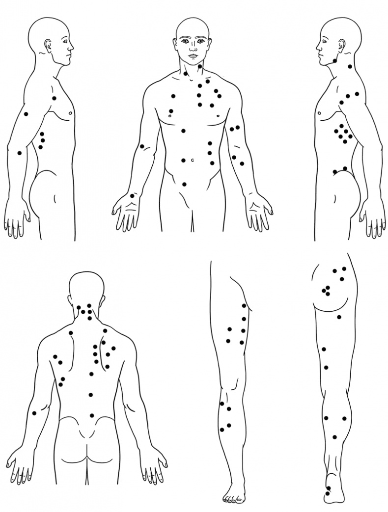 Иллюстрация к книге — Работа с триггерными точками: расслабляем мышцы, избавляемся от боли [_02.jpg]
