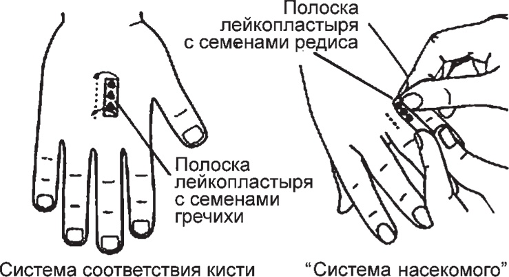 Иллюстрация к книге — Суджок - исцеляющий самомассаж. Основные приемы [autogen_ebook_id42.jpg]