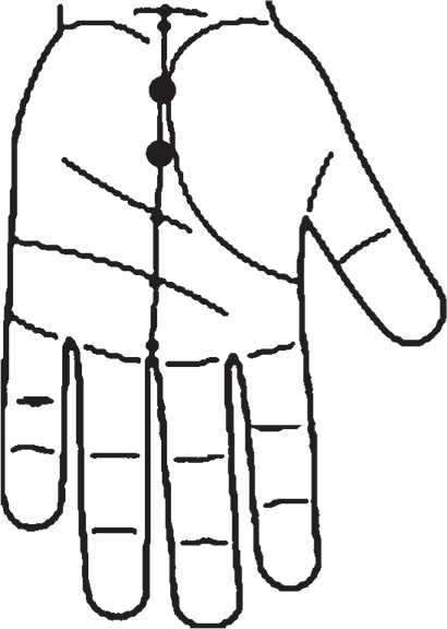 Иллюстрация к книге — Суджок - исцеляющий самомассаж. Основные приемы [autogen_ebook_id49.jpg]