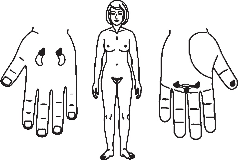 Иллюстрация к книге — Суджок - исцеляющий самомассаж. Основные приемы [autogen_ebook_id57.jpg]