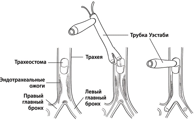 Иллюстрация к книге — Хрупкие жизни. Истории кардиохирурга о профессии, где нет места сомнениям и страху [i_004.jpg]