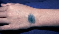 Иллюстрация к книге — Опасные родинки [autogen_ebook_id126.jpg]