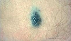 Иллюстрация к книге — Опасные родинки [autogen_ebook_id127.jpg]