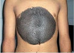 Иллюстрация к книге — Опасные родинки [autogen_ebook_id128.jpg]