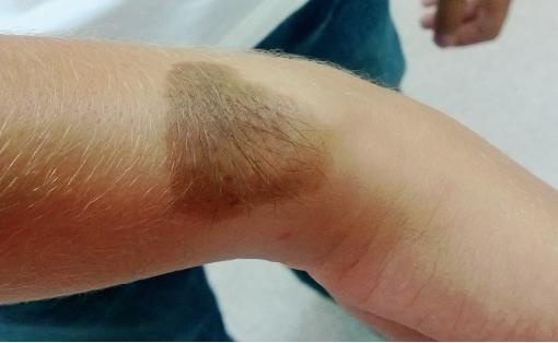 Иллюстрация к книге — Опасные родинки [autogen_ebook_id132.jpg]