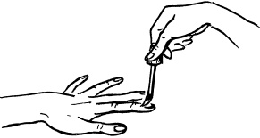 Иллюстрация к книге — Опасные родинки [autogen_ebook_id5.jpg]