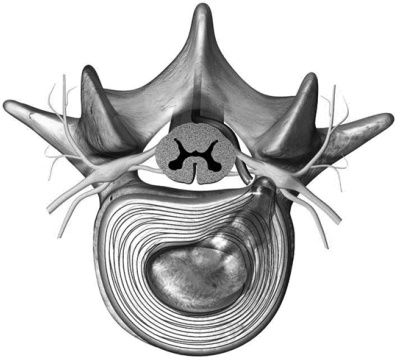 Иллюстрация к книге — Лечение позвоночника. Научитесь жить без боли в спине [_03_fmt.jpg]