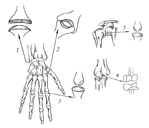 Иллюстрация к книге — Лечение спины и суставов. Новейшие рекомендации. Методы лечения. Советы специалистов [i_003.jpg]