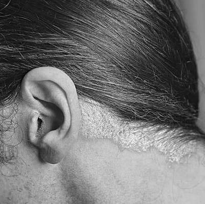 Иллюстрация к книге — Псориаз. Диета, лечение, профилактика [i_002.jpg]