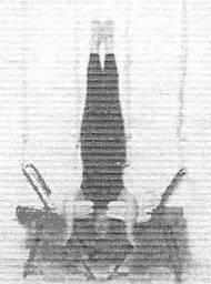 Иллюстрация к книге — Новая йога для тех, кому за 50: обратите вспять процессы старения. Руководство по йоге для людей среднего и старшего возраста [image33.jpg]