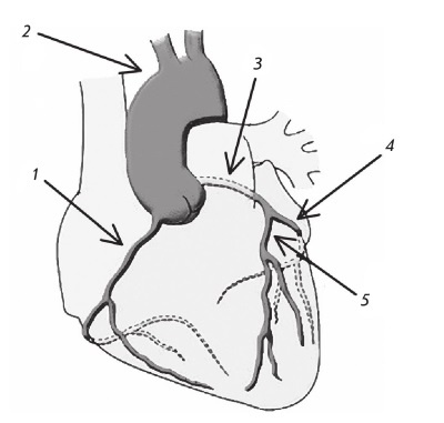 Иллюстрация к книге — Стенокардия [i_002.jpg]