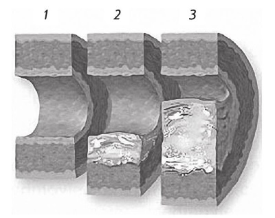 Иллюстрация к книге — Стенокардия [i_008.jpg]