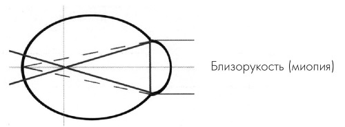 Иллюстрация к книге — Как учиться и не испортить зрение [i_019.jpg]