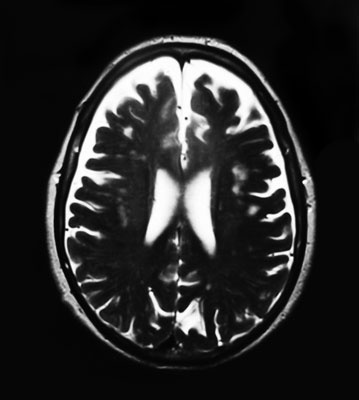 Иллюстрация к книге — Как забыть все забывать. 15 простых привычек, чтобы не искать ключи по всей квартире [i_003.jpg]