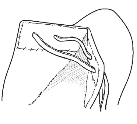 Иллюстрация к книге — Обувь для дома своими руками [i_102.jpg]