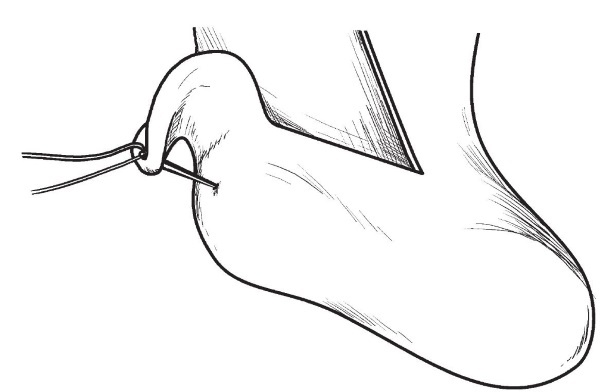 Иллюстрация к книге — Обувь для дома своими руками [i_250.jpg]