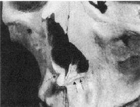 Иллюстрация к книге — Эректус бродит между нами. Покорение белой расы [p922.jpg]