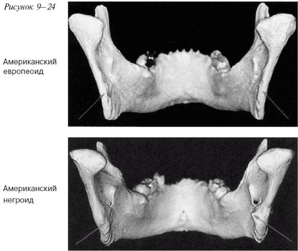 Иллюстрация к книге — Эректус бродит между нами. Покорение белой расы [p924.jpg]