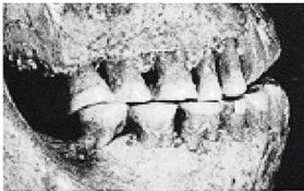 Иллюстрация к книге — Эректус бродит между нами. Покорение белой расы [p929.jpg]