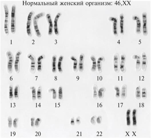 Иллюстрация к книге — Мусорная ДНК. Путешествие в темную материю генома [i_020.jpg]