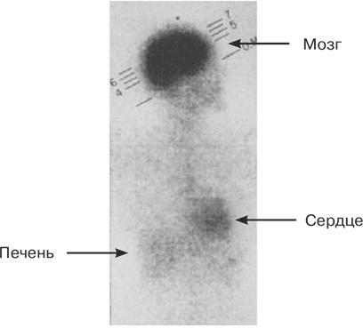 Иллюстрация к книге — Почему девочки не хуже мальчиков разбираются в математике [i_030.jpg]