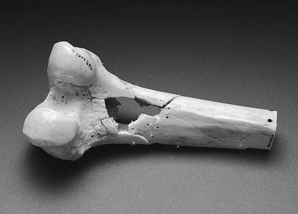 Иллюстрация к книге — Дуэль нейрохирургов. Как открывали тайны мозга, и почему смерть одного короля смогла перевернуть науку [i_019.jpg]