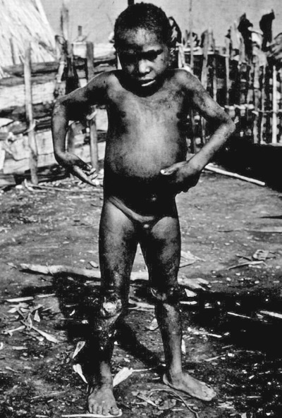 Иллюстрация к книге — Дуэль нейрохирургов. Как открывали тайны мозга, и почему смерть одного короля смогла перевернуть науку [i_024.jpg]