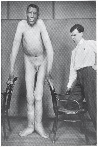 Иллюстрация к книге — Дуэль нейрохирургов. Как открывали тайны мозга, и почему смерть одного короля смогла перевернуть науку [i_028.jpg]