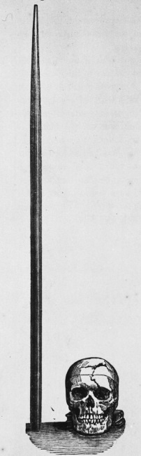 Иллюстрация к книге — Дуэль нейрохирургов. Как открывали тайны мозга, и почему смерть одного короля смогла перевернуть науку [i_046.jpg]