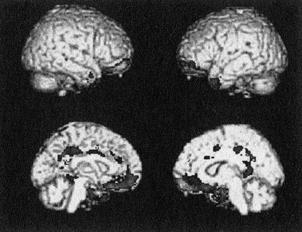 Иллюстрация к книге — Психопаты. Достоверный рассказ о людях без жалости, без совести, без раскаяния [i_008.jpg]