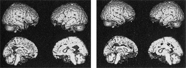 Иллюстрация к книге — Психопаты. Достоверный рассказ о людях без жалости, без совести, без раскаяния [i_009.jpg]