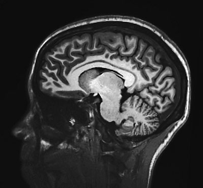 Иллюстрация к книге — Коннектом. Как мозг делает нас тем, что мы есть [i_006.jpg]