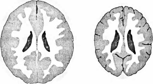 Иллюстрация к книге — Мы - это наш мозг. От матки до Альцгеймера [i_009.jpg]